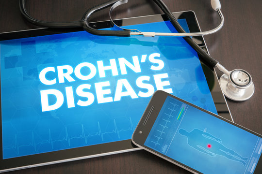 Crohn's disease (gastrointestinal disease related) diagnosis medical concept on tablet screen with stethoscope