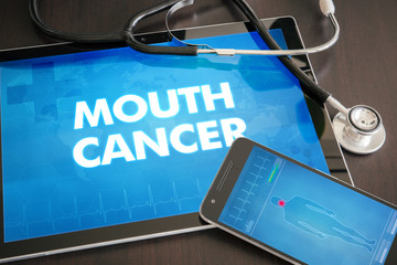 Mouth cancer (cancer type) diagnosis medical concept on tablet screen with stethoscope
