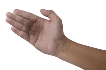 hair loss problem on hand isolated on white