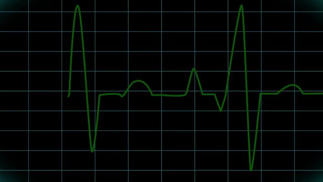 Cardiogram. Animated EKG Display.