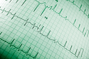 Electrocardiogram