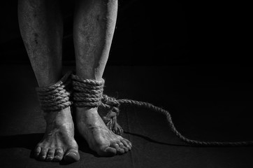 A man with bound legs.