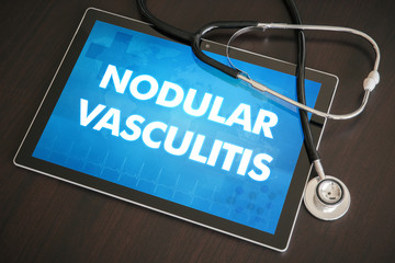 Nodular vasculitis (cutaneous disease) diagnosis medical concept on tablet screen with stethoscope