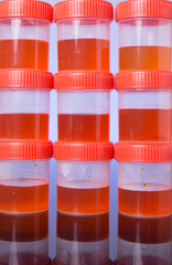 Pile of urine sample tube