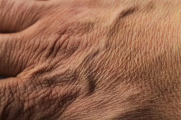 An image of a hand