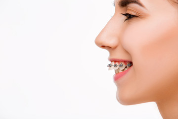 Fototapeta premium Piękna młoda kobieta z szelkami na zęby