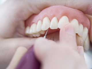 Dental technician is working with porcelain teeth in a cast molde in dental laboratory