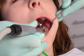 Dentist  drilling  tooth of a young patient, dental procedure