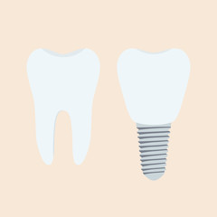 Medical denture. Human teeth, dentist implant in cartoon flat style.