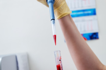 microbiological pipette in the genetic laboratory