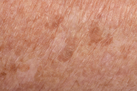 Detail of texture skin, senior woman,arm
