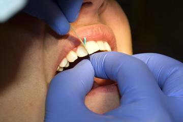 Dentist examining a patients teeth in the dentists chair under bright light at the dental clinic
