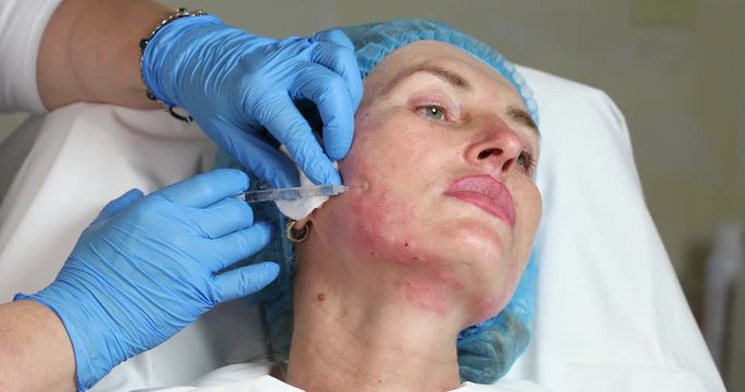 Cosmetic treatment with injection in a clinic 
