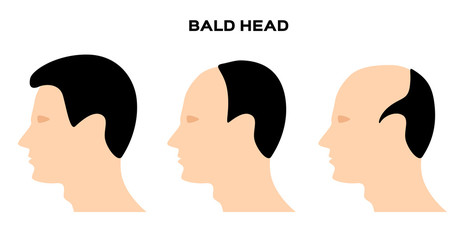bald head vector . no hair