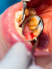 dental treatment in dentistry