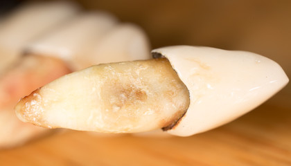 tooth torn. macro
