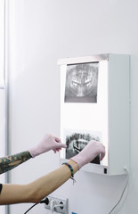 Female doctor dentist looking at x-ray
