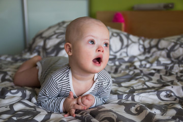 Portrait of cute baby boy with Down syndrome