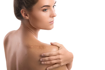 Woman with a scar on her shoulder - obrazy, fototapety, plakaty