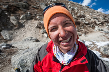 Trekker with burned skin on face is smiling at camera in Khumbu valley on a way to Everest Base camp