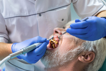 Elderly man with yellow teeth. Dentist is curing patient.