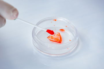 Young doctor working on blood test in lab hospital