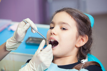 Close-up of pretty little girl opening his mouth wide during treating her teeth by the dentist