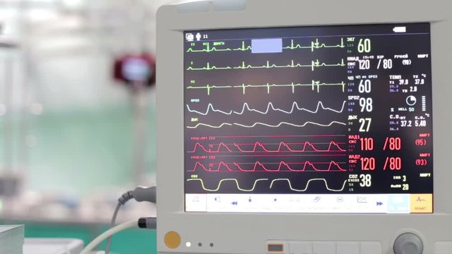 Medical screen that displays the parameters of the heart