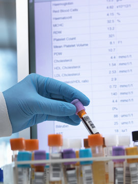 Medical Testing, Haematologist checking medical samples including blood for testing with results on the computer screen