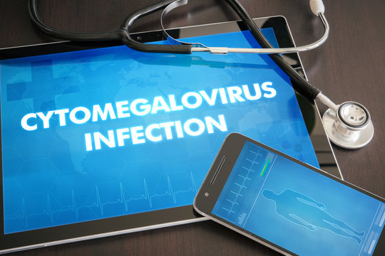 Cytomegalovirus infection (neurological disorder) diagnosis medical concept on tablet screen with stethoscope