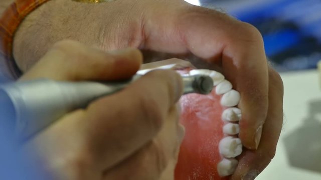 Dental technician doing partial dentures in the lab.