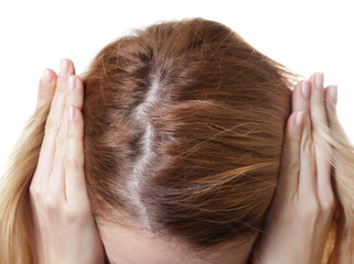 Young woman with hair loss problem on white background, closeup