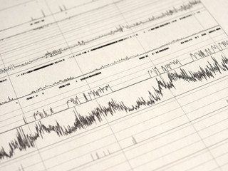 Fototapeta premium polysomnography (PSG) sleep study