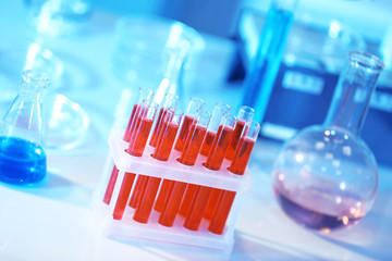 Test tubes with blood in laboratory on table