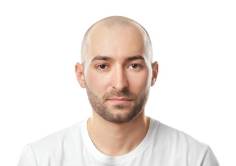 Hair loss concept. Portrait of young bald man on white background
