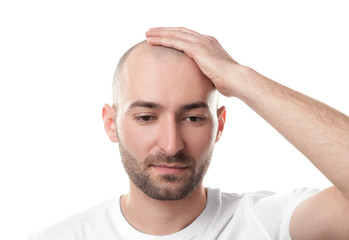 Hair loss concept. Man touching his bald head on white background - obrazy, fototapety, plakaty