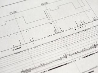 polysomnography (PSG) sleep study