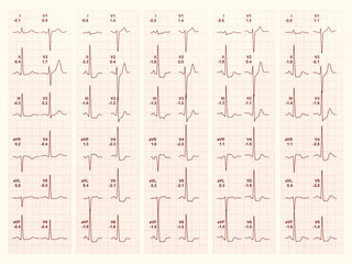 electrocardiography of heart beat