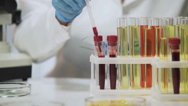 Clinical test, laboratory scientist analyzing blood samples under microscope