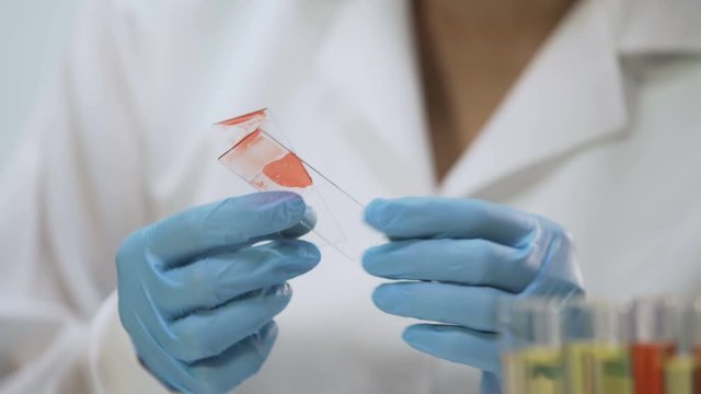 Biochemical research, female medic analyzing blood sample using microscope