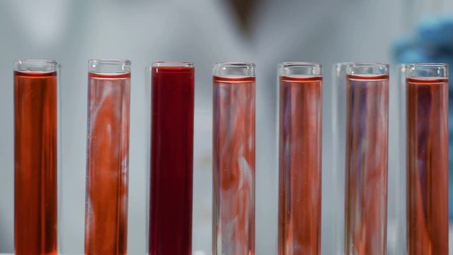 Lab assistant working with test tubes, examining blood samples in laboratory