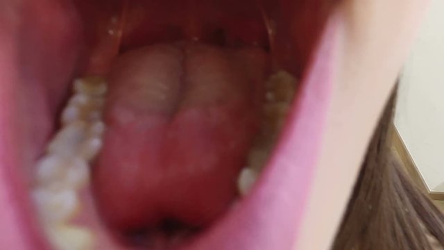 Close up of beautiful little girl sitting in the dental chair with open mouth