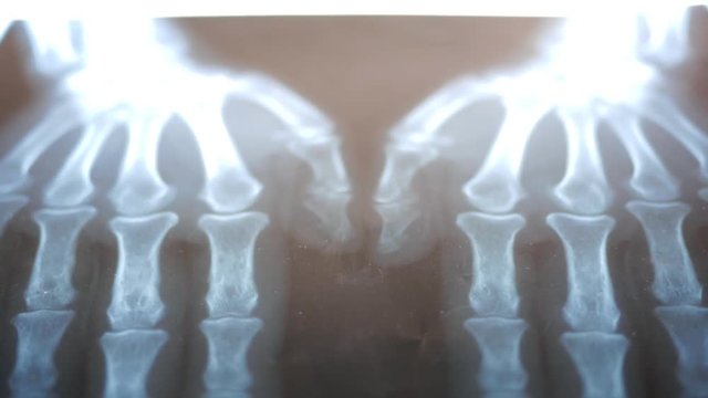 X-ray of the hands on black background