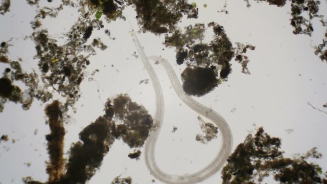 Nematode under the microscope in 4k