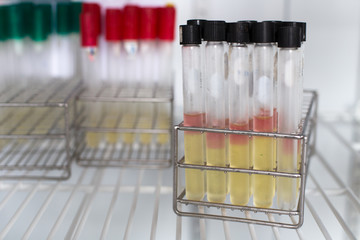 Beaker, flask, tube and glove for experiment chemical in Lab.