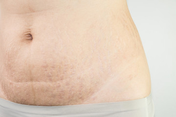 woman with Belly pattern