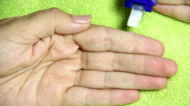 Caucasian woman starts applying medicine to wart on her index finger. Close up of female hand. Real time full hd video footage.
