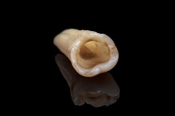 The remote tooth is damaged by caries on a black background. Macro.