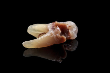 The remote tooth is damaged by caries on a black background. Macro.