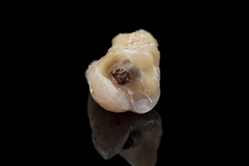 The remote tooth is damaged by caries on a black background. Macro.